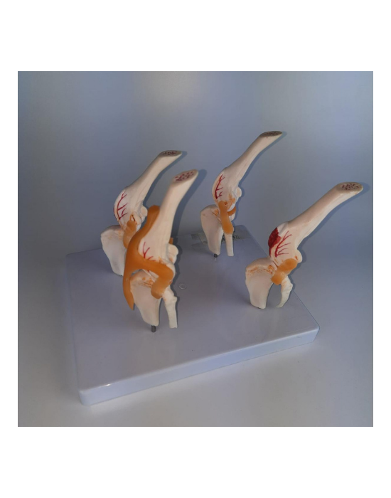 Erkent Sağlık Ürünleri