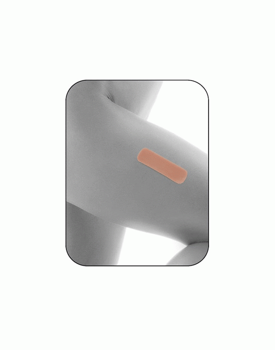 Erkent Sağlık Ürünleri