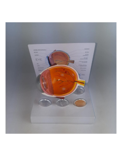 ERKENTMED G12 KATARAKT HASTALIĞI GÖZ MODELİ