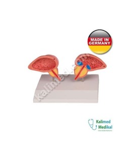 1261 PROSTAT MODELİ 2 PARÇA