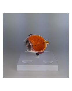 ERKENTMED G11 KORNEA HASTALIĞI GÖZ MODELİ